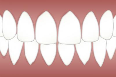 implant dentaire deuil la barre
